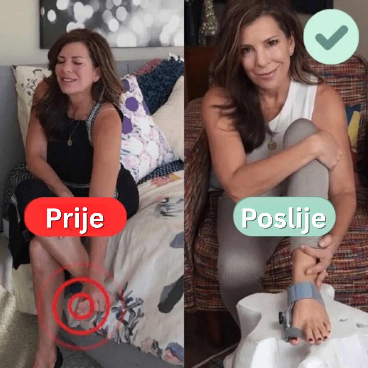 Terapijski paket za čukljeve (Hallux Valgus)