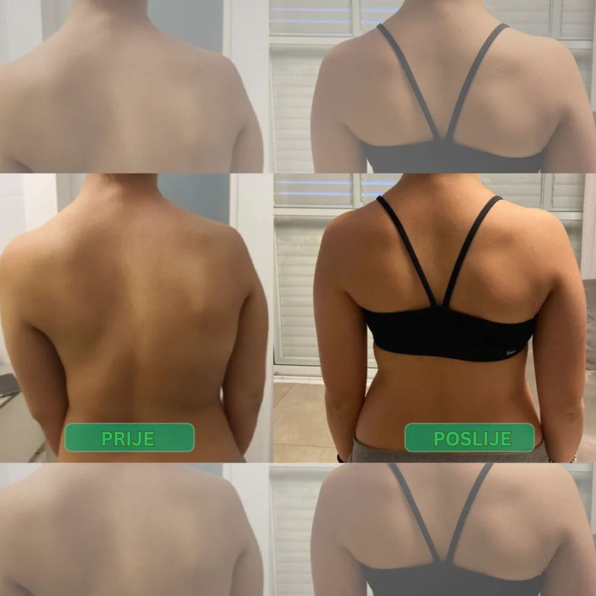 Ispravljač držanja s trenutnim djelovanjem – Stani uspravno. Olakšaj leđa. Osjeti razliku već od prvog dana.