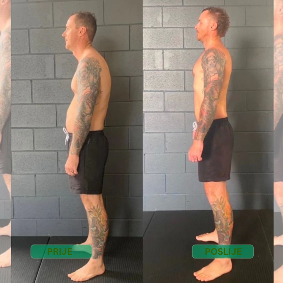 Ispravljač držanja s trenutnim djelovanjem – Stani uspravno. Olakšaj leđa. Osjeti razliku već od prvog dana.