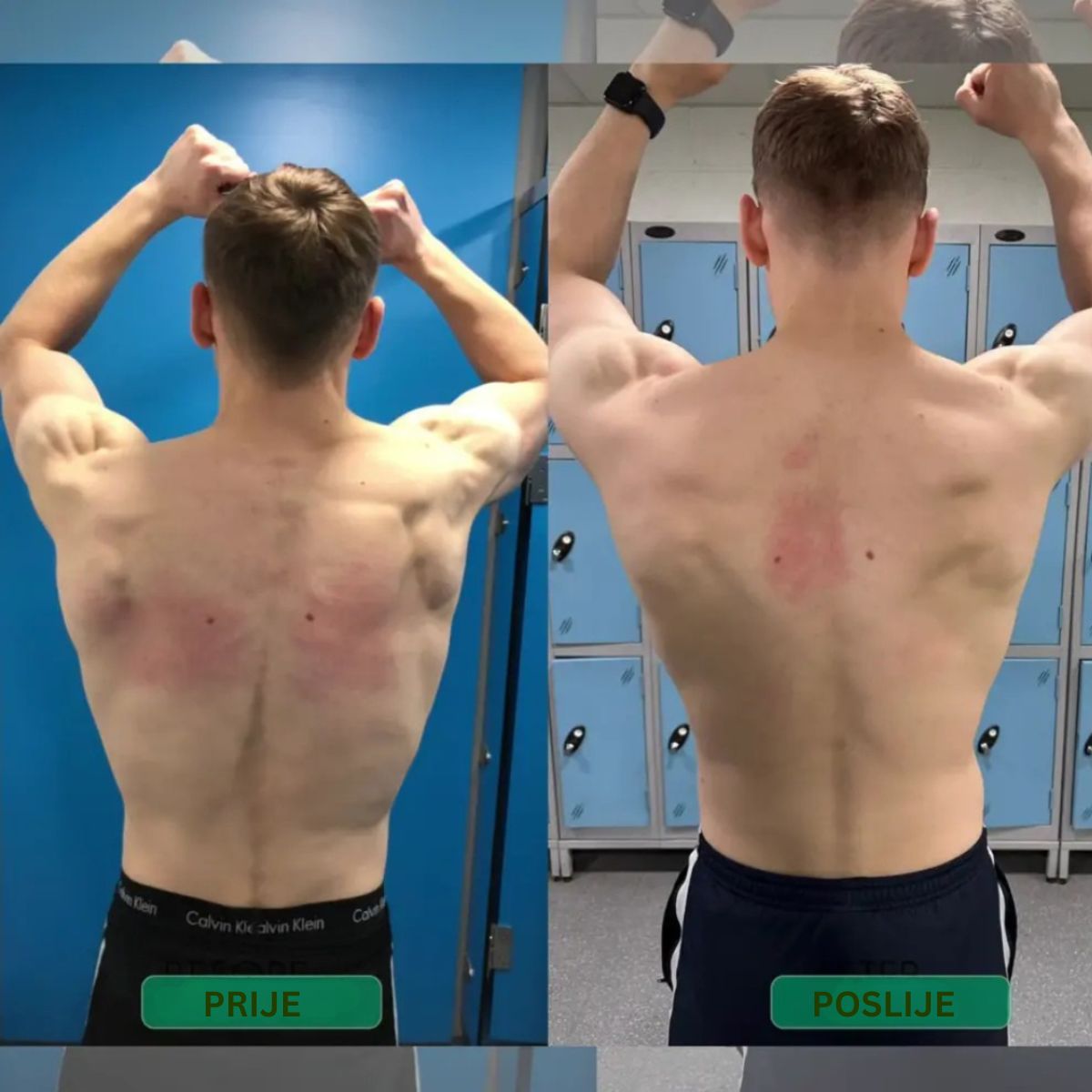 Ispravljač držanja s trenutnim djelovanjem – Stani uspravno. Olakšaj leđa. Osjeti razliku već od prvog dana.