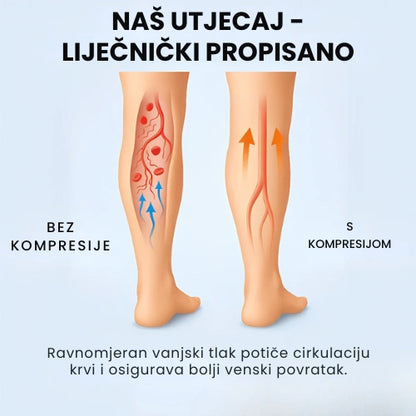 Zenstride® Prozračne kompresijske čarape za stopala i noge bez boli