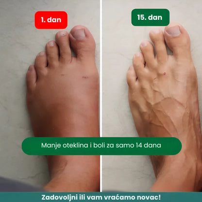 Zenstride® Prozračne kompresijske čarape za stopala i noge bez boli